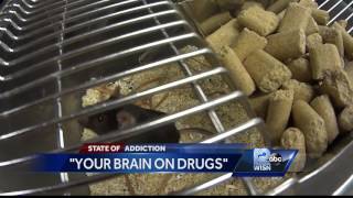 How Opioids, Heroin Physically Alter The Human Brain