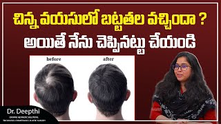 బట్టతల వచ్చిందా? | Hair Growth Tips In Telugu | Solution For Baldness | Socialpost Health