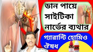 ডান পায়ের সাইটিকা নার্ভের ব্যাথা  ।।  হোমিও ঔষধ  ।।    homeopaty medicine for right leg pain