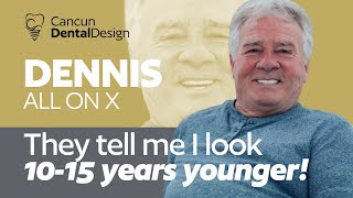 [2024]Cancun Dental Design Review | Dennis' Amazing All-on-4 Transformation | Dental Tourism