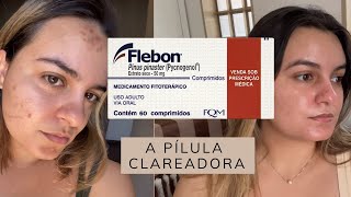 PICNOGENOL PARA MELASMA | A pílula que clareia manchas com resultados comprovados