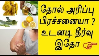 Solution for Skin Diseases|  தோல் அரிப்பு  பிரச்சனையா ? உடனடி தீர்வு இதோ