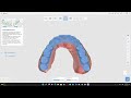 medit trainer s corner understanding medit splints