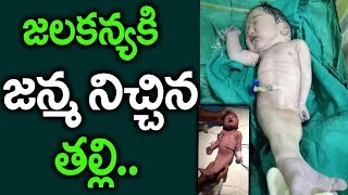 జలకన్యకు జన్మనిచ్చిన తల్లి || Mother Gave Birth to Mermaid Baby || Unknown Facts || SumanTV Life