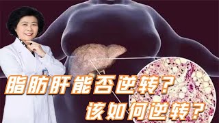 脂肪肝能否逆轉？該如何逆轉？聽教授給大家科普！ 【黃立坤】 #全科醫生 #中醫 #養生