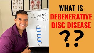 Degenerative Disc Disease - Symptoms & Diagnosis
