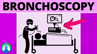 Rigid Bronchoscopy (Medical Definition) | Quick Explainer Video