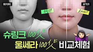 울쎄라 100샷 vs 슈링크 100샷, 반반 시술 받아봤습니다