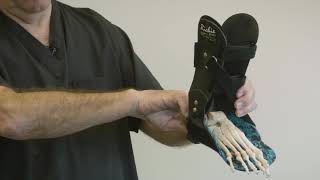 Clinical Pearls of AFO Therapy - Flanges and Lateral Forefoot Abduction