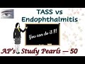 TASS vs Endophthalmitis | AP's Study Pearls 50