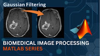 Gaussian Filter || MATLAB Code Implementation || Medical Image Processing | Computer Vision