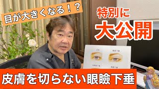 【特別に大公開！】目が大きくなる！？志賀院長が得意とする結膜側から行う眼瞼下垂の手術