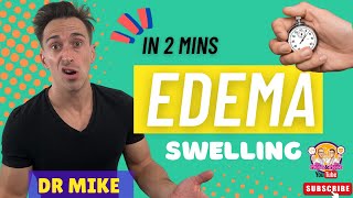 Edema (Oedema) | In 2 minutes!