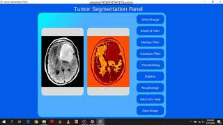 Brain tumor Segmentation using Python and openCV- PyQt GUI interface