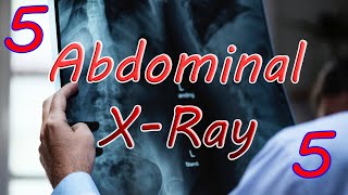 Colitis, Toxic megacolon, Fecal impaction | Abdominal X-Ray (5)