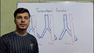 Tracheoesophageal Anomalies # EA # TEF