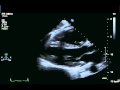 Echocardiographic Studies for Evaluation of Persistent Hypotension