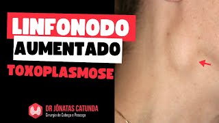 Linfonodo no pescoço aumentado - toxoplasmose