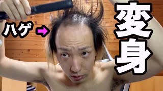 【ハゲのヘアセット術】薄毛男子の本気 髪型セットルーティン【超変化】