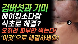 검버섯 흑자 기미 싹 녹아져 나갑니다? 베이킹 소다 와 식초 한방울!? 오히려 피부만 썩습니다! '이것'으로 해결하세요!