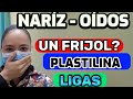 CUERPO EXTRAÑO EN NIÑOS.    👉SE METIÓ UN OBJETO EN LA NARIZ Y OIDOS⁉️