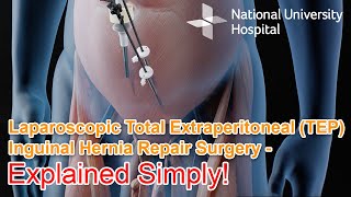 Laparoscopic Total Extraperitoneal (TEP) Inguinal Hernia Repair Surgery - Explained
