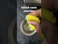 lemon for dandruff lemon dandruff dandruffremedies