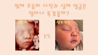 입체 초음파와 실제 얼굴 전격 비교해보기 l 얼마나 비슷할까요?