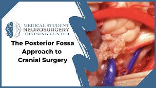 The Posterior Fossa Approach to Cranial Surgery