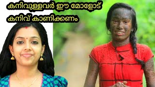 നമുക്ക് ഒന്നിച്ചു നമ്മളെ പോലെ  ഒരാൾ ആകാൻ ഈ മോളോട് കരുണ കാണിക്കാം |