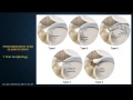 Current Management of meniscus injury, Dr.Bancha Chernchujit รศ.นพ.บัญชา ชื่นชูจิตต์