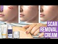 7 Best Scar Removal Cream |  Scar Treatment That Actually Works