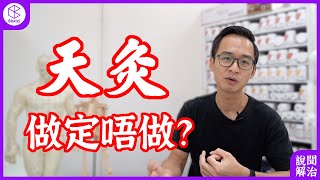 To天灸or not 天灸？This is a question！【說聞解治】#28