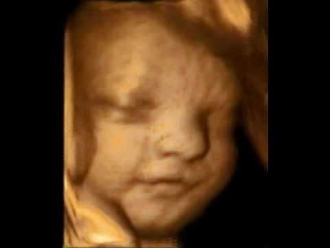 29 Weeks Pregnant 2d Ultrasound