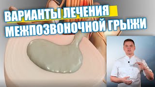 Тема: межпозвонковые грыжи и варианты их лечения