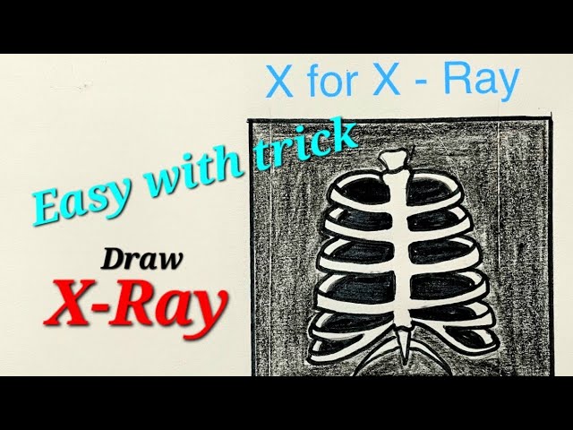 X Ray Drawing For Kids