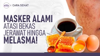 Atasi Flek Hitam dengan Bahan Eksfoliasi Wajah Alami! Begini Caranya | Hidup Sehat tvOne