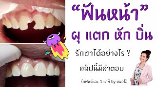 ฟันหน้าผุ แตก หัก บิ่น ฟันไม่สวยรักษาได้ไหม #รักฟันวันละ1นาทีbyหมอโอ๋