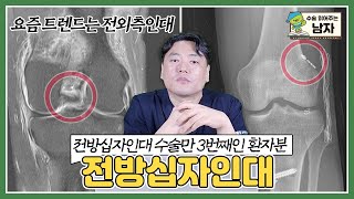 전방십자인대 수술만 3번째인 환자분😹｜전방십자인대 수술 케이스｜수술 읽어주는 남자👨‍⚕️