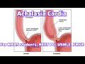 Esophageal Motility Disorder part 2 (Achalasia cardia) For MBBS students, Neet PG, Usmle, FMGE