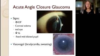 Lecture: Angle Closure: A Global Issue