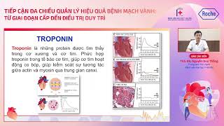 Chẩn đoán và điều trị hội chứng vành cấp không ST chênh lên