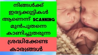 Early Signs and Symptoms of a Twin Pregnancy| Malayalam