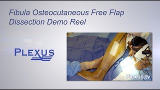 Fibula Osteocutaneous Free Flap Dissection Video