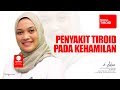 PENYAKIT TIROID PADA KEHAMILAN - MODUL TIROID - dr. LAKSMI SASIARINI, SpPD, KEMD