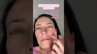 Marionette Lines Treatment | Wrinkles Schminkles Self-Dissolving Microneedle Patches