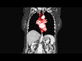 A Man Played Video Games Nonstop For 73 Hours This Is How His Organs Shut Down A Man Played Video Games Nonstop For 73 Hours This Is How His Organs Shut Down