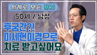 [새로운병원 척추보안관] 50세 협착증환자의 후궁간미세현미경감압술 전후 MRI 비교  feat. 당신은 럭키가이!(50세 남성 실제사례)