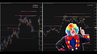 Watch a Dip Trap form within a Trend using advanced Sierra Chart Order Flow Tools