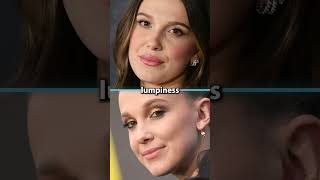 Plastic Surgeon Reacts To Millie Bobby Brown's Facial Transformation